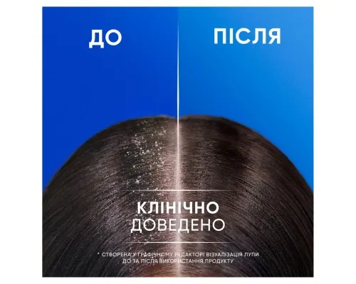 Шампунь Head & Shoulders 2 в 1 Проти лупи Свіжість ментолу 400 мл (8700216305419)