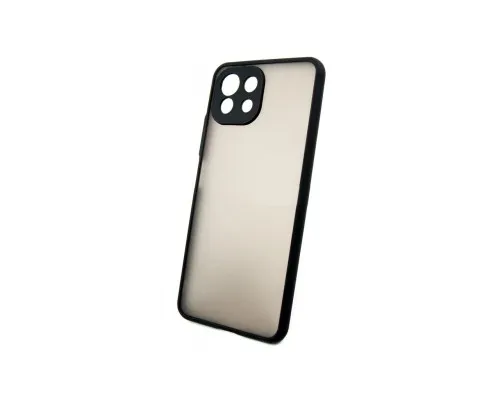 Чохол до мобільного телефона Dengos Matte Xiaomi 11 Lite 5G NE (DG-TPU-MATT-89)