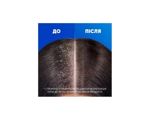 Шампунь Head & Shoulders Для чутливої шкіри 400 мл (5011321336124)